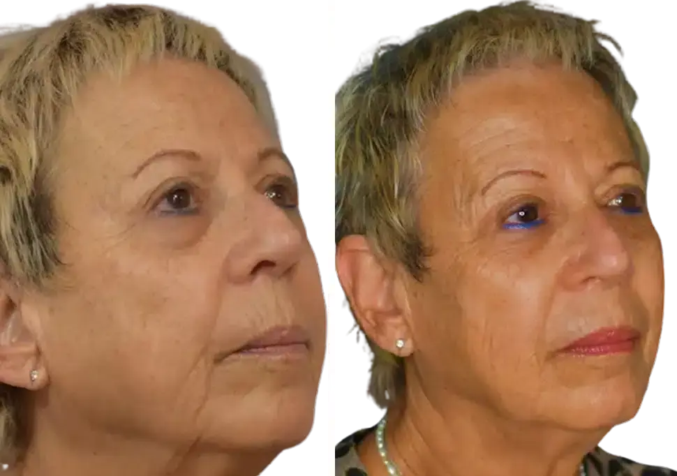 cellenis derma face 3 - Aesthetic Management Partners - Medical Aesthetics Equipment For The Modern Practice