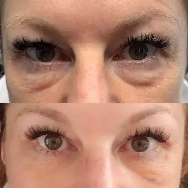 Agnes Eyes DermFX - Aesthetic Management Partners - Medical Aesthetics Equipment For The Modern Practice
