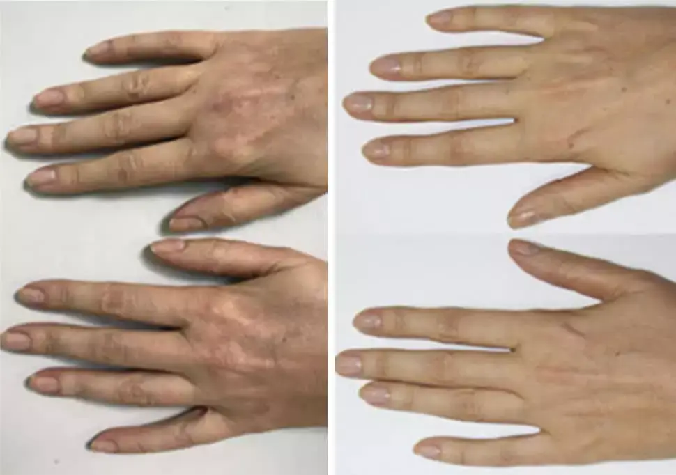 cellenis derma hands - Aesthetic Management Partners - Medical Aesthetics Equipment For The Modern Practice