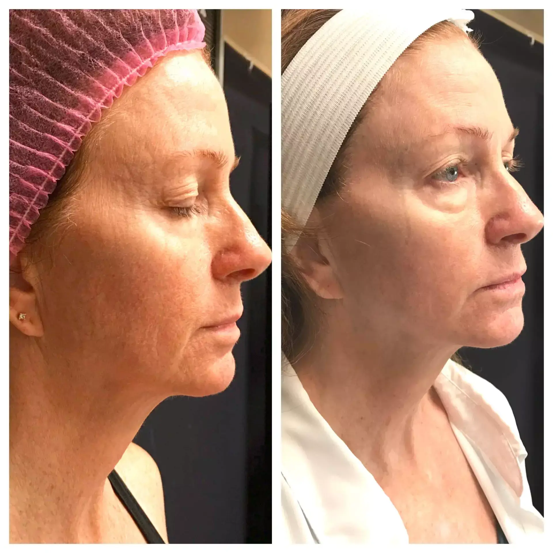 Scarlet Face GoodyearsFamilyMedicine R.View - Aesthetic Management Partners - Medical Aesthetics Equipment For The Modern Practice