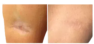 cellenis derma skin - Aesthetic Management Partners - Medical Aesthetics Equipment For The Modern Practice