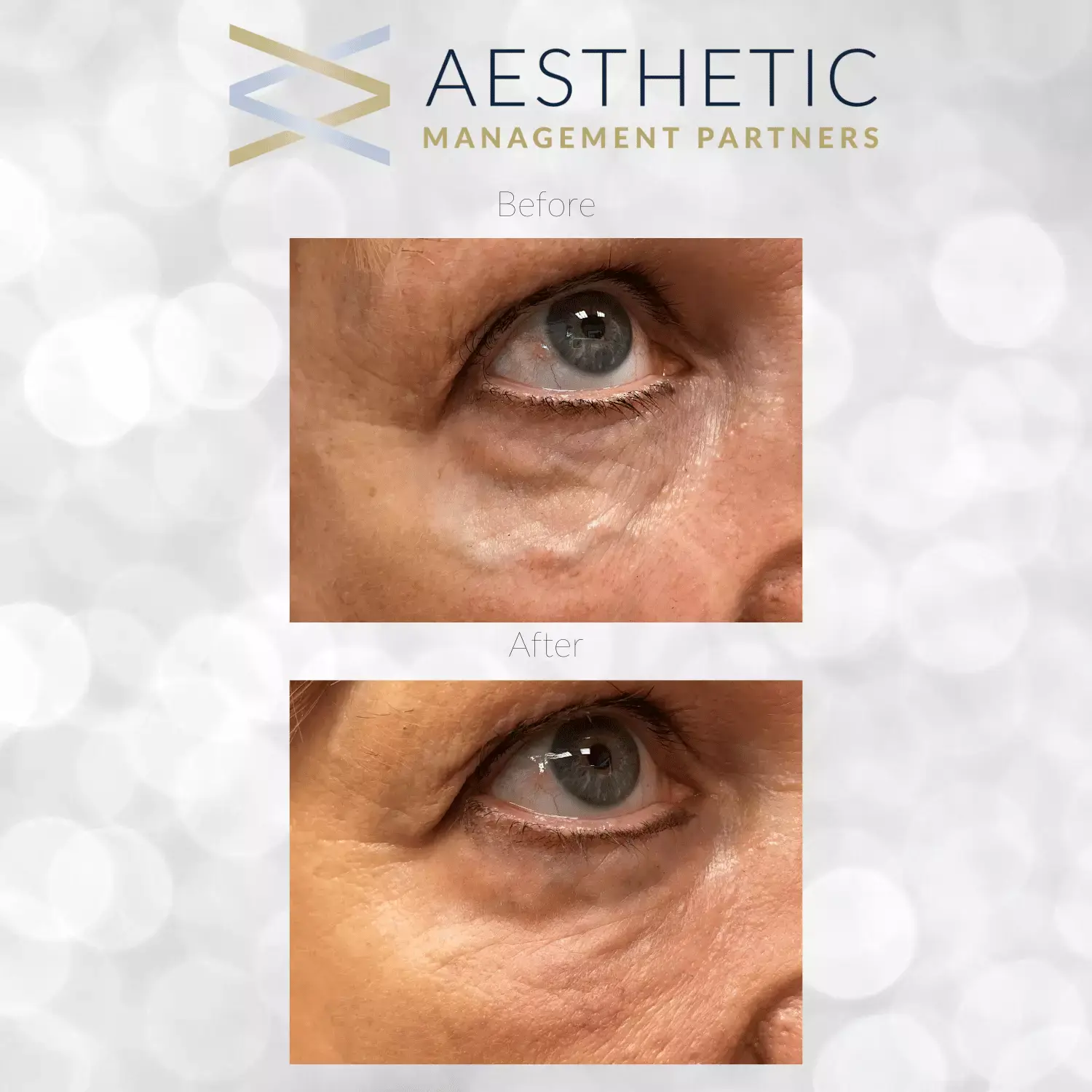 Agnes PeriorbialVeinClosure Dr.Lo - Aesthetic Management Partners - Medical Aesthetics Equipment For The Modern Practice